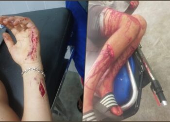 الجديدة.. اعتداء دموي على شقيقين بحي سيدي موسى يثير الرعب بين السكان